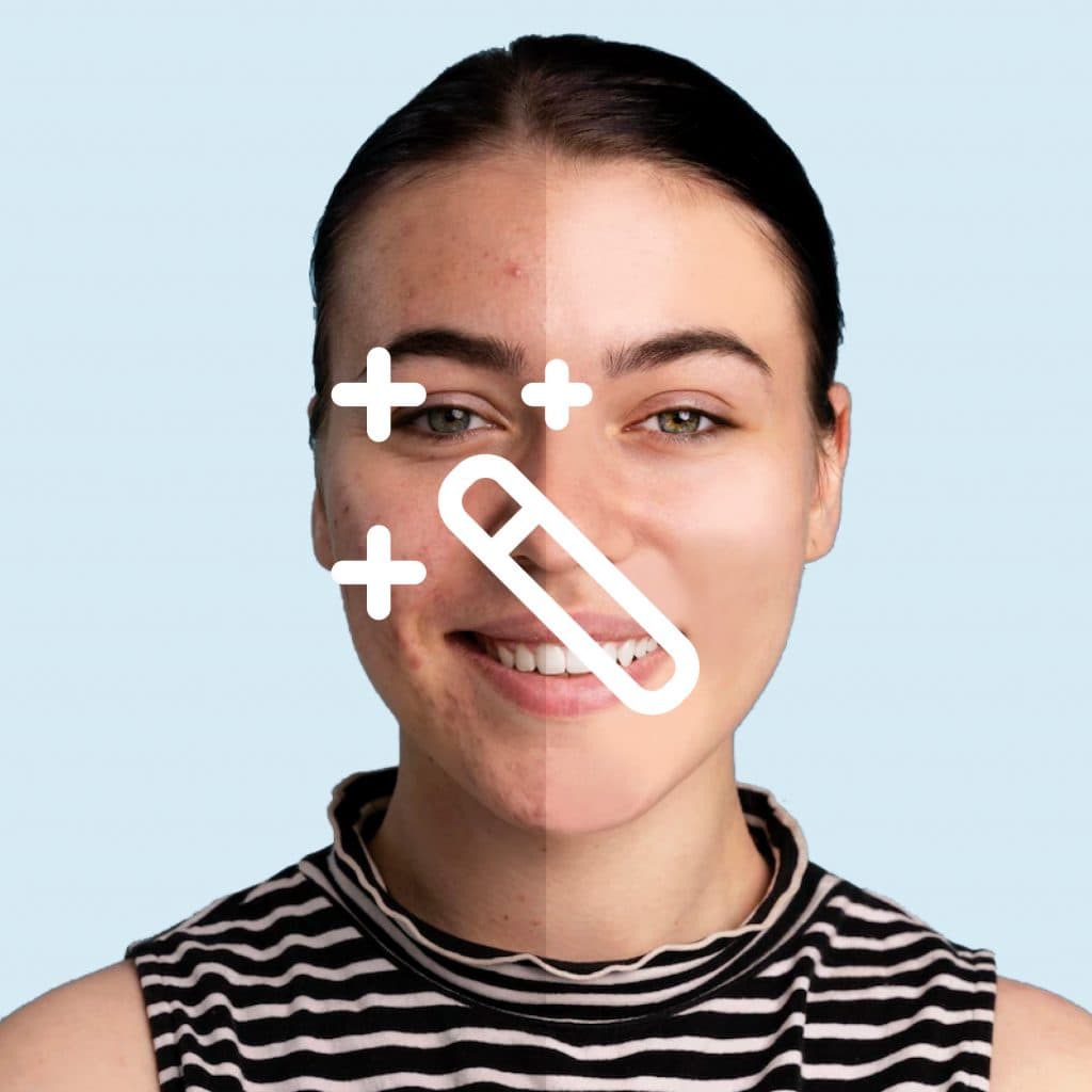 Retusointti